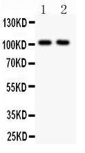 Figure 2. Western blot analysis of GRIA1 using anti-GRIA1 antibody (PB9204). Electrophoresis was performed on a 5-20% SDS-PAGE gel at 70V (Stacking gel) / 90V (Resolving gel) for 2-3 hours. The sample well of each lane was loaded with 50ug of sample under reducing conditions. Lane 1: Rat Brain Tissue Lysate, Lane 2: Mouse Brain Tissue Lysate. After Electrophoresis, proteins were transferred to a Nitrocellulose membrane at 150mA for 50-90 minutes. Blocked the membrane with 5% Non-fat Milk/ TBS for 1.5 hour at RT. The membrane was incubated with rabbit anti-GRIA1 antigen affinity purified polyclonal antibody (Catalog # PB9204) at 0.5 microg/mL overnight at 4°C, then washed with TBS-0.1%Tween 3 times with 5 minutes each and probed with a goat anti-rabbit IgG-HRP secondary antibody at a dilution of 1:10000 for 1.5 hour at RT. The signal is developed using an Enhanced Chemiluminescent detection (ECL) kit (Catalog # EK1002) with Tanon 5200 system. A specific band was detected for GRIA1 at approximately 101KD. The expected band size for GRIA1 is at 101KD.