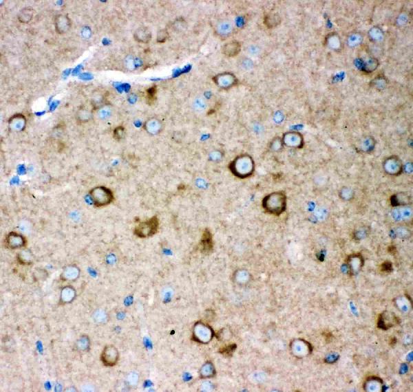 Figure 2. IHC analysis of GRIA2 using anti-GRIA2 antibody (PB9205). GRIA2 was detected in paraffin-embedded section of Mouse Brain Tissue. Heat mediated antigen retrieval was performed in citrate buffer (pH6, epitope retrieval solution) for 20 mins. The tissue section was blocked with 10% goat serum. The tissue section was then incubated with 1microg/ml rabbit anti-GRIA2 Antibody (PB9205) overnight at 4°C. Biotinylated goat anti-rabbit IgG was used as secondary antibody and incubated for 30 minutes at 37°C. The tissue section was developed using Strepavidin-Biotin-Complex (SABC)(Catalog # SA1022) with DAB as the chromogen. Figure 2. IHC analysis of GRIA2 using anti-GRIA2 antibody (PB9205). GRIA2 was detected in paraffin-embedded section of Mouse Brain Tissue. Heat mediated antigen retrieval was performed in citrate buffer (pH6, epitope retrieval solution) for 20 mins. The tissue section was blocked with 10% goat serum. The tissue section was then incubated with 1microg/ml rabbit anti-GRIA2 Antibody (PB9205) overnight at 4°C. Biotinylated goat anti-rabbit IgG was used as secondary antibody and incubated for 30 minutes at 37°C. The tissue section was developed using Strepavidin-Biotin-Complex (SABC)(Catalog # SA1022) with DAB as the chromogen.