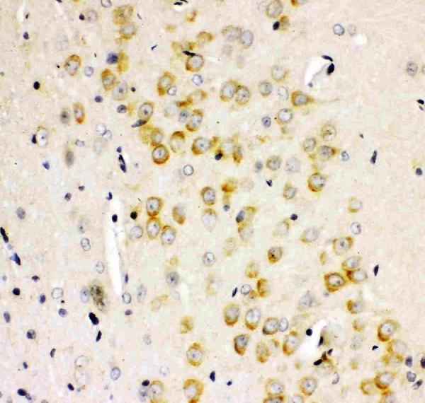 Figure 3. IHC analysis of GRIA2 using anti-GRIA2 antibody (PB9205). GRIA2 was detected in paraffin-embedded section of Rat Brain Tissue. Heat mediated antigen retrieval was performed in citrate buffer (pH6, epitope retrieval solution) for 20 mins. The tissue section was blocked with 10% goat serum. The tissue section was then incubated with 1microg/ml rabbit anti-GRIA2 Antibody (PB9205) overnight at 4°C. Biotinylated goat anti-rabbit IgG was used as secondary antibody and incubated for 30 minutes at 37°C. The tissue section was developed using Strepavidin-Biotin-Complex (SABC)(Catalog # SA1022) with DAB as the chromogen. Figure 3. IHC analysis of GRIA2 using anti-GRIA2 antibody (PB9205). GRIA2 was detected in paraffin-embedded section of Rat Brain Tissue. Heat mediated antigen retrieval was performed in citrate buffer (pH6, epitope retrieval solution) for 20 mins. The tissue section was blocked with 10% goat serum. The tissue section was then incubated with 1microg/ml rabbit anti-GRIA2 Antibody (PB9205) overnight at 4°C. Biotinylated goat anti-rabbit IgG was used as secondary antibody and incubated for 30 minutes at 37°C. The tissue section was developed using Strepavidin-Biotin-Complex (SABC)(Catalog # SA1022) with DAB as the chromogen.