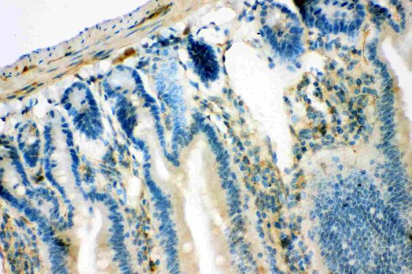 Anti-IRS1 antibody, PB9223, IHC(P) IHC(P): Mouse Intestine Tissue