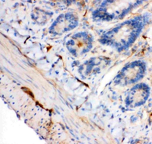 Anti-IRS1 antibody, PB9223, IHC(P) IHC(P): Rat Intestine Tissue