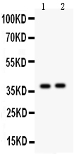 pb9248 1 WB anti calretinin picoband antibody