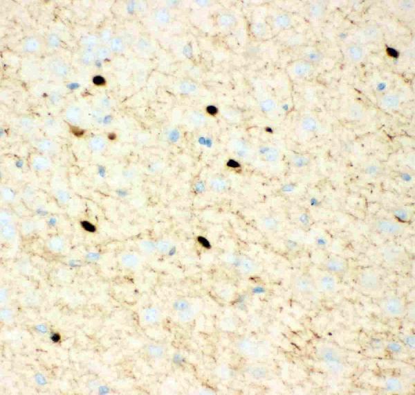 pb9248 2 IHC anti calretinin picoband antibody