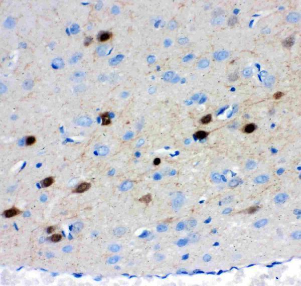 pb9248 3 IHC anti calretinin picoband antibody