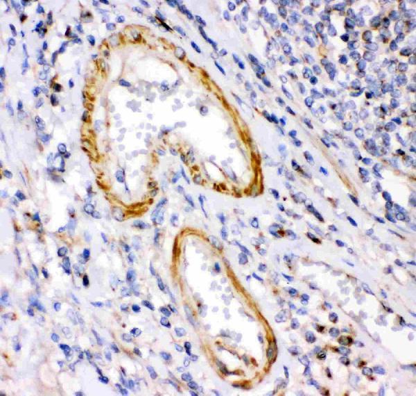 pb9248 4 IHC anti calretinin picoband antibody