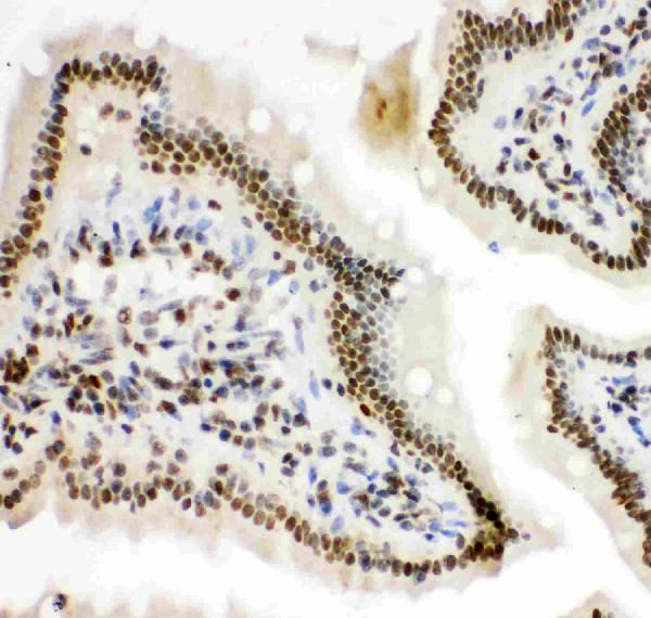 pb9253 3 IHC anti hif 1 alpha picoband antibody