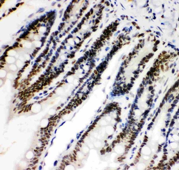 pb9253 4 IHC anti hif 1 alpha picoband antibody