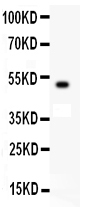 pb9258 1 WB anti kit scfr antibody