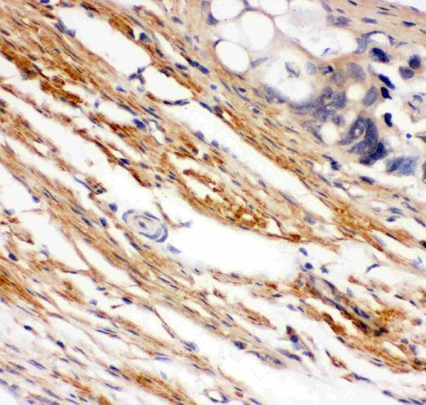 pb9258 3 IHC anti kit scfr antibody