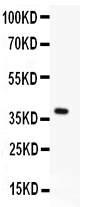 pb9263 1 WB anti menin picoband antibody