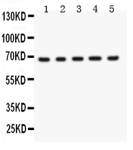 pb9263 2 WB anti menin picoband antibody