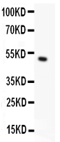 pb9271 1 WB anti trpc5 picoband antibody