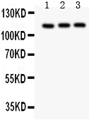 pb9271 2 WB anti trpc5 picoband antibody