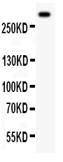 Anti-VWF Picoband antibody, PB9273, Western blotting All lanes: Anti VWF (PB9273) at 0.5ug/ml WB: Mouse Lung Tissue Lysate at 50ug Predicted bind size: 309KD Observed bind size: 309KD
