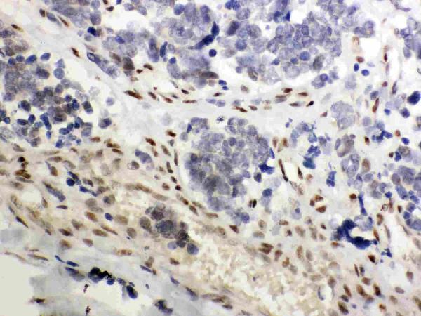  IHC analysis of NR3C1 using anti-NR3C1 antibody (PB9342)