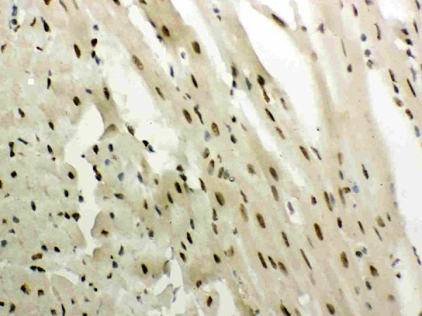 pb9342 4 IHC anti nr3c1 glucocorticoid receptor picoband antibody