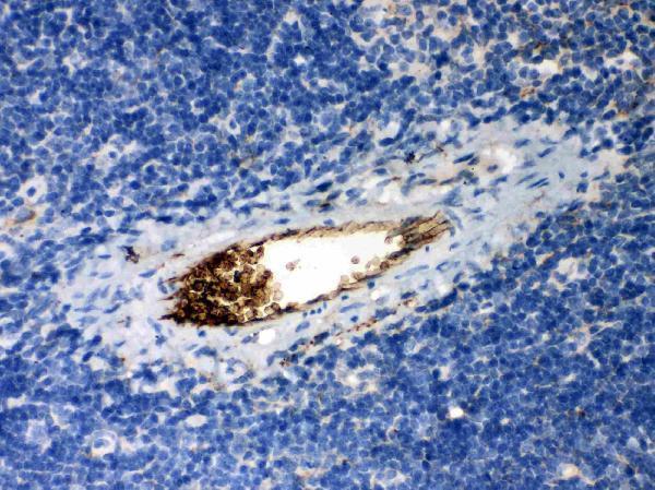pb9354 3 IHC anti serpina1 alpha 1 antitrypsin picoband antibody