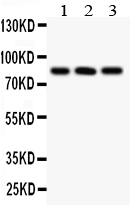 pb9382 1 WB anti calcineurin a picoband antibody