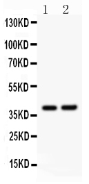 Anti-SOX1 Picoband antibody, PB9403, Western blotting All lanes: Anti SOX1 (PB9403) at 0.5ug/ml Lane 1: Rat Brain Tissue Lysate at 50ug Lane 2: NIH3T3 Whole Cell Lysate at 40ug Predicted bind size: 39KD Observed bind size: 39KD