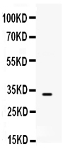 Figure 1. Western blot analysis of SNAI3 using anti-SNAI3 antibody (PB9440). Electrophoresis was performed on a 5-20% SDS-PAGE gel at 70V (Stacking gel) / 90V (Resolving gel) for 2-3 hours. Lane 1: MCF-7 Whole Cell Lysate at 40ug. After electrophoresis, proteins were transferred to a nitrocellulose membrane at 150 mA for 50-90 minutes. Blocked the membrane with 5% non-fat milk/TBS for 1.5 hour at RT. The membrane was incubated with rabbit anti-SNAI3 antigen affinity purified polyclonal antibody (Catalog # PB9440) at 0.5 microg/mL overnight at 4°C, then washed with TBS-0.1%Tween 3 times with 5 minutes each and probed with a goat anti-rabbit IgG-HRP secondary antibody at a dilution of 1:5000 for 1.5 hour at RT. The signal is developed using an Enhanced Chemiluminescent detection (ECL) kit (Catalog # EK1002) with Tanon 5200 system. A specific band was detected for SNAI3 at approximately 32 kDa. The expected band size for SNAI3 is at 32 kDa.