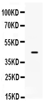 Figure 1. Western blot analysis of SP5 using anti-SP5 antibody (PB9443). Electrophoresis was performed on a 5-20% SDS-PAGE gel at 70V (Stacking gel) / 90V (Resolving gel) for 2-3 hours. Lane 1: MCF-7 Whole Cell Lysate at 40ug. After electrophoresis, proteins were transferred to a nitrocellulose membrane at 150 mA for 50-90 minutes. Blocked the membrane with 5% non-fat milk/TBS for 1.5 hour at RT. The membrane was incubated with rabbit anti-SP5 antigen affinity purified polyclonal antibody (Catalog # PB9443) at 0.5 microg/mL overnight at 4°C, then washed with TBS-0.1%Tween 3 times with 5 minutes each and probed with a goat anti-rabbit IgG-HRP secondary antibody at a dilution of 1:5000 for 1.5 hour at RT. The signal is developed using an Enhanced Chemiluminescent detection (ECL) kit (Catalog # EK1002) with Tanon 5200 system. A specific band was detected for SP5 at approximately 42 kDa. The expected band size for SP5 is at 42 kDa.
