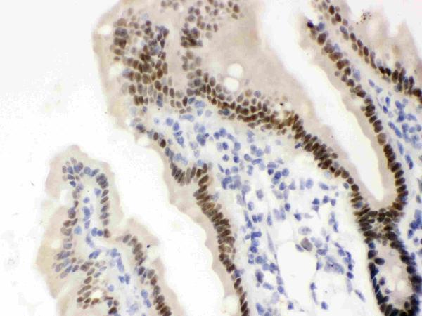 pb9456 2 IHC anti vdr nr1i1 picoband antibody
