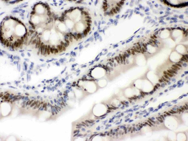 pb9456 3 IHC anti vdr nr1i1 picoband antibody