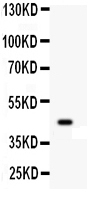pb9462 1 WB anti wnt2b picoband antibody