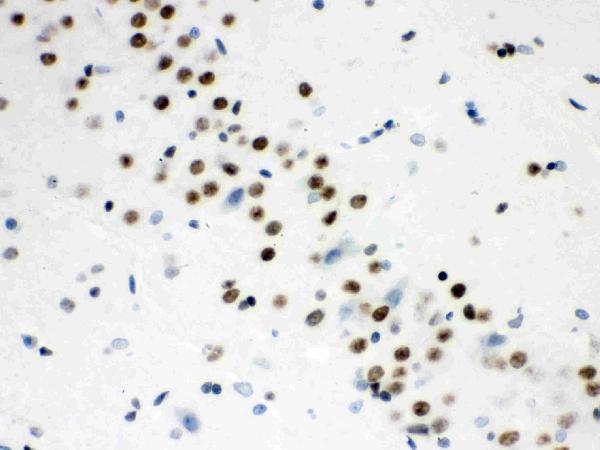 pb9462 3 IHC anti wnt2b picoband antibody