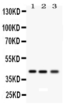  Western blot analysis of RAGE using anti-RAGE antibody (PB9469)