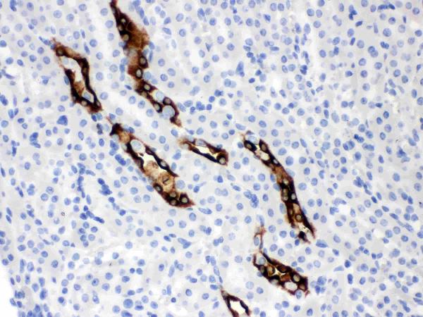 IHC analysis of Aquaporin 2 using anti-Aquaporin 2 antibody (PB9474). Aquaporin 2 was detected in paraffin-embedded section of Mouse Kidney Tissue. Heat mediated antigen retrieval was performed in citrate buffer (pH6, epitope retrieval solution) for 20 mins. The tissue section was blocked with 10% goat serum. The tissue section was then incubated with 1μg/ml rabbit anti-Aquaporin 2 Antibody (PB9474) overnight at 4°C. Biotinylated goat anti-rabbit IgG was used as secondary antibody and incubated for 30 minutes at 37°C. The tissue section was developed using Strepavidin-Biotin-Complex (SABC)(Catalog # SA1022) with DAB as the chromogen.