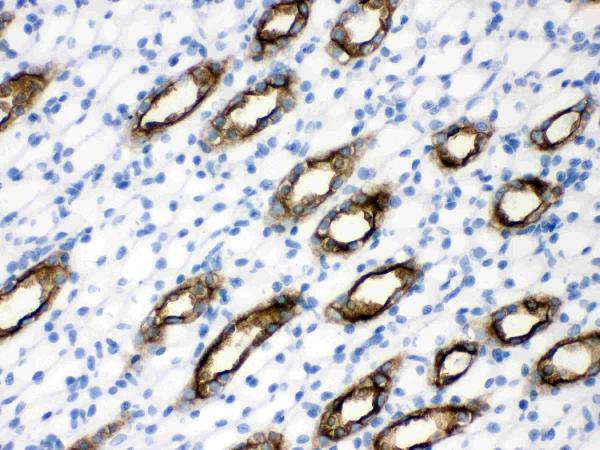 IHC analysis of Aquaporin 2 using anti-Aquaporin 2 antibody (PB9474). Aquaporin 2 was detected in paraffin-embedded section of Rat Kidney Tissue. Heat mediated antigen retrieval was performed in citrate buffer (pH6, epitope retrieval solution) for 20 mins. The tissue section was blocked with 10% goat serum. The tissue section was then incubated with 1μg/ml rabbit anti-Aquaporin 2 Antibody (PB9474) overnight at 4°C. Biotinylated goat anti-rabbit IgG was used as secondary antibody and incubated for 30 minutes at 37°C. The tissue section was developed using Strepavidin-Biotin-Complex (SABC)(Catalog # SA1022) with DAB as the chromogen.