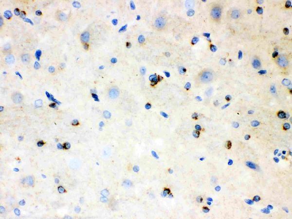 pb9476 3_2 IHC anti aplp1 picoband antibody