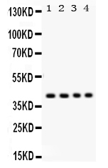 Figure 1. Western blot analysis of Parvin alpha using anti-Parvin alpha antibody (PB9555). Electrophoresis was performed on a 5-20% SDS-PAGE gel at 70V (Stacking gel) / 90V (Resolving gel) for 2-3 hours. Lane 1: Rat Liver Tissue Lysate at 50ug, Lane 2: HELA Whole Cell Lysate at 40ug, Lane 3: SW620 Whole Cell Lysate at 40ug, Lane 4: HEPA Whole Cell Lysate at 40ug. After electrophoresis, proteins were transferred to a nitrocellulose membrane at 150 mA for 50-90 minutes. Blocked the membrane with 5% non-fat milk/TBS for 1.5 hour at RT. The membrane was incubated with rabbit anti-Parvin alpha antigen affinity purified polyclonal antibody (Catalog # PB9555) at 0.5 microg/mL overnight at 4°C, then washed with TBS-0.1%Tween 3 times with 5 minutes each and probed with a goat anti-rabbit IgG-HRP secondary antibody at a dilution of 1:5000 for 1.5 hour at RT. The signal is developed using an Enhanced Chemiluminescent detection (ECL) kit (Catalog # EK1002) with Tanon 5200 system. A specific band was detected for Parvin alpha at approximately 42 kDa. The expected band size for Parvin alpha is at 42 kDa.