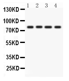 Figure 1. Western blot analysis of PKC eta using anti-PKC eta antibody (PB9556). Electrophoresis was performed on a 5-20% SDS-PAGE gel at 70V (Stacking gel) / 90V (Resolving gel) for 2-3 hours. The sample well of each lane was loaded with 50ug of sample under reducing conditions. Lane 1: A431 Whole Cell Lysate Lane 2: A549 Whole Cell Lysate Lane 3: HELA Whole Cell Lysate Lane 4: SKOV Whole Cell Lysate After Electrophoresis, proteins were transferred to a Nitrocellulose membrane at 150mA for 50-90 minutes. Blocked the membrane with 5% Non-fat Milk/ TBS for 1.5 hour at RT. The membrane was incubated with rabbit anti-PKC eta antigen affinity purified polyclonal antibody (Catalog # PB9556) at 0.5 microg/mL overnight at 4°C, then washed with TBS-0.1%Tween 3 times with 5 minutes each and probed with a goat anti-rabbit IgG-HRP secondary antibody at a dilution of 1:10000 for 1.5 hour at RT. The signal is developed using an Enhanced Chemiluminescent detection (ECL) kit (Catalog # EK1002) with Tanon 5200 system. A specific band was detected for PKC eta at approximately 78KD. The expected band size for PKC eta is at 78KD.