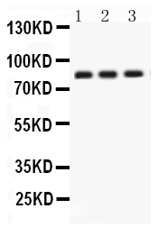  Western blot analysis of Apolipoprotein J using anti-Apolipoprotein J antibody (PB9575)