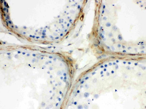  IHC analysis of Apolipoprotein J using anti-Apolipoprotein J antibody (PB9575)