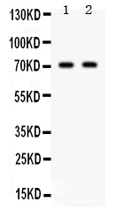 Figure 1. Western blot analysis of Frizzled homolog 1 using anti-Frizzled homolog 1 antibody (PB9594). Electrophoresis was performed on a 5-20% SDS-PAGE gel at 70V (Stacking gel) / 90V (Resolving gel) for 2-3 hours. Lane 1: 22RV1 Whole Cell Lysate at 40ug, Lane 2: 293T Whole Cell Lysate at 40ug. After electrophoresis, proteins were transferred to a nitrocellulose membrane at 150 mA for 50-90 minutes. Blocked the membrane with 5% non-fat milk/TBS for 1.5 hour at RT. The membrane was incubated with rabbit anti-Frizzled homolog 1 antigen affinity purified polyclonal antibody (Catalog # PB9594) at 0.5 microg/mL overnight at 4°C, then washed with TBS-0.1%Tween 3 times with 5 minutes each and probed with a goat anti-rabbit IgG-HRP secondary antibody at a dilution of 1:5000 for 1.5 hour at RT. The signal is developed using an Enhanced Chemiluminescent detection (ECL) kit (Catalog # EK1002) with Tanon 5200 system. A specific band was detected for Frizzled homolog 1 at approximately 71 kDa. The expected band size for Frizzled homolog 1 is at 71 kDa.