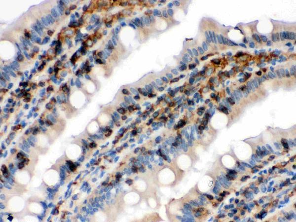 pb9620 3 IHC anti cofilin picoband antibody