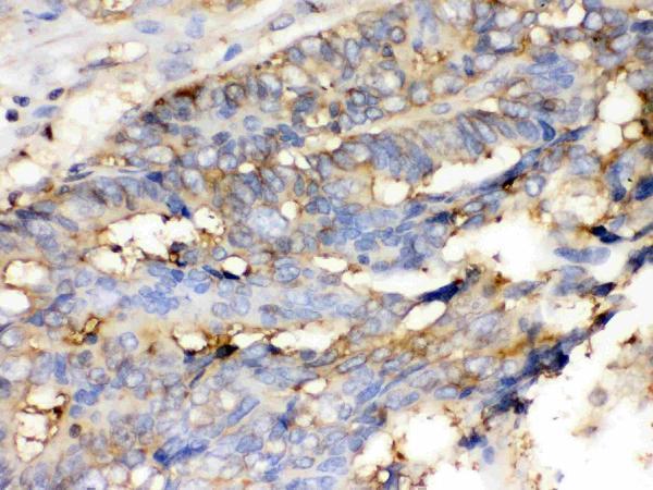 pb9620 4 IHC anti cofilin picoband antibody
