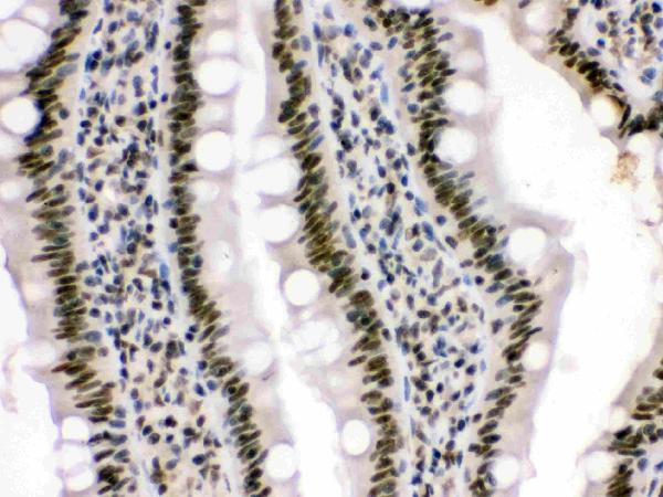 Figure 3. IHC analysis of HMG4 using anti-HMG4 antibody (PB9633). HMG4 was detected in a paraffin-embedded section of rat intestine tissue. Heat mediated antigen retrieval was performed in EDTA buffer (pH 8.0, epitope retrieval solution). The tissue section was blocked with 10% goat serum. The tissue section was then incubated with 1 microg/ml rabbit anti-HMG4 Antibody (PB9633) overnight at 4°C. Biotinylated goat anti-rabbit IgG was used as secondary antibody and incubated for 30 minutes at 37°C. The tissue section was developed using Strepavidin-Biotin-Complex (SABC) (Catalog # SA1022) with DAB as the chromogen. Figure 3. IHC analysis of HMG4 using anti-HMG4 antibody (PB9633). HMG4 was detected in a paraffin-embedded section of rat intestine tissue. Heat mediated antigen retrieval was performed in EDTA buffer (pH 8.0, epitope retrieval solution). The tissue section was blocked with 10% goat serum. The tissue section was then incubated with 1 microg/ml rabbit anti-HMG4 Antibody (PB9633) overnight at 4°C. Biotinylated goat anti-rabbit IgG was used as secondary antibody and incubated for 30 minutes at 37°C. The tissue section was developed using Strepavidin-Biotin-Complex (SABC) (Catalog # SA1022) with DAB as the chromogen.