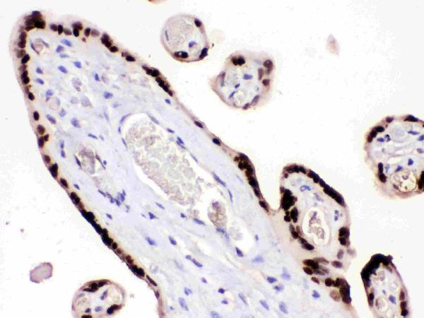 Figure 4. IHC analysis of HMG4 using anti-HMG4 antibody (PB9633). HMG4 was detected in a paraffin-embedded section of human placenta tissue. Heat mediated antigen retrieval was performed in EDTA buffer (pH 8.0, epitope retrieval solution). The tissue section was blocked with 10% goat serum. The tissue section was then incubated with 1 microg/ml rabbit anti-HMG4 Antibody (PB9633) overnight at 4°C. Biotinylated goat anti-rabbit IgG was used as secondary antibody and incubated for 30 minutes at 37°C. The tissue section was developed using Strepavidin-Biotin-Complex (SABC) (Catalog # SA1022) with DAB as the chromogen. Figure 4. IHC analysis of HMG4 using anti-HMG4 antibody (PB9633). HMG4 was detected in a paraffin-embedded section of human placenta tissue. Heat mediated antigen retrieval was performed in EDTA buffer (pH 8.0, epitope retrieval solution). The tissue section was blocked with 10% goat serum. The tissue section was then incubated with 1 microg/ml rabbit anti-HMG4 Antibody (PB9633) overnight at 4°C. Biotinylated goat anti-rabbit IgG was used as secondary antibody and incubated for 30 minutes at 37°C. The tissue section was developed using Strepavidin-Biotin-Complex (SABC) (Catalog # SA1022) with DAB as the chromogen.