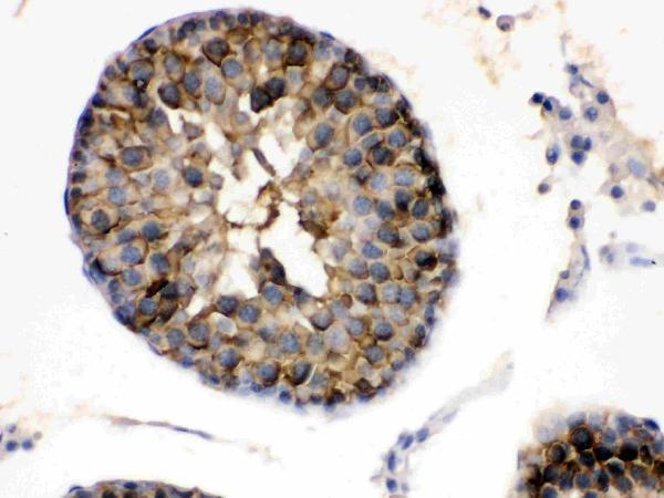 pb9635 3 IHC anti hsp90 alpha picoband antibody