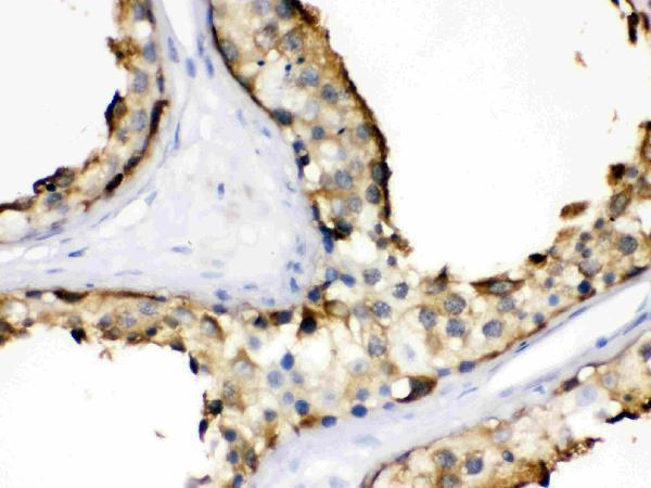 pb9635 4 IHC anti hsp90 alpha picoband antibody