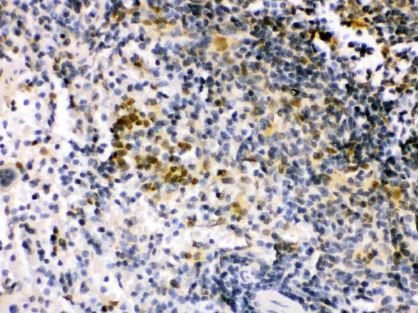pb9646 2 IHC anti irf5 picoband antibody