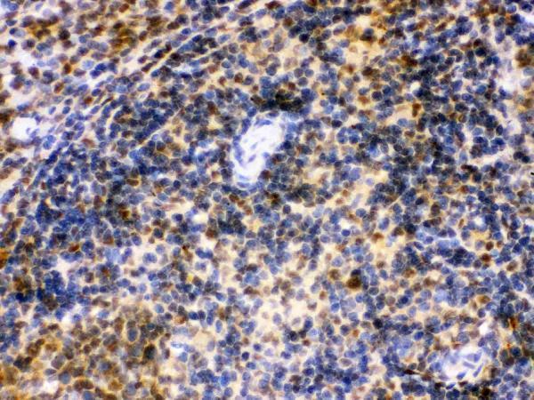 pb9646 3 IHC anti irf5 picoband antibody