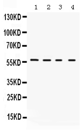 Figure 1. Western blot analysis of Kv1.2 using anti-Kv1.2 antibody (PB9649). Electrophoresis was performed on a 5-20% SDS-PAGE gel at 70V (Stacking gel) / 90V (Resolving gel) for 2-3 hours. Lane 1: Rat Kidney Tissue Lysate at 50ug, Lane 2: Rat Brain Tissue Lysate at 50ug, Lane 3: Mouse Brain Tissue Lysate at 50ug, Lane 4: Mouse Kidney Tissue Lysate at 50ug. After electrophoresis, proteins were transferred to a nitrocellulose membrane at 150 mA for 50-90 minutes. Blocked the membrane with 5% non-fat milk/TBS for 1.5 hour at RT. The membrane was incubated with rabbit anti-Kv1.2 antigen affinity purified polyclonal antibody (Catalog # PB9649) at 0.5 microg/mL overnight at 4°C, then washed with TBS-0.1%Tween 3 times with 5 minutes each and probed with a goat anti-rabbit IgG-HRP secondary antibody at a dilution of 1:5000 for 1.5 hour at RT. The signal is developed using an Enhanced Chemiluminescent detection (ECL) kit (Catalog # EK1002) with Tanon 5200 system. A specific band was detected for Kv1.2 at approximately 57 kDa. The expected band size for Kv1.2 is at 57 kDa.