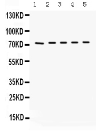  Western blot analysis of Kininogen 1 using anti-Kininogen 1 antibody (PB9655)