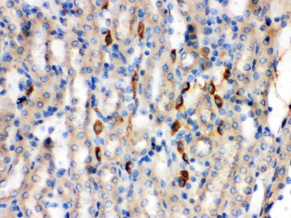  IHC analysis of Kininogen 1 using anti-Kininogen 1 antibody (PB9655)