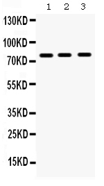 Figure 1. Western blot analysis of MMP-9 using anti-MMP-9 antibody (PB9669). Electrophoresis was performed on a 5-20% SDS-PAGE gel at 70V (Stacking gel) / 90V (Resolving gel) for 2-3 hours. The sample well of each lane was loaded with 40 ug of sample under reducing conditions. Lane 1: NRK Whole Cell Lysate, Lane 2: ANA-1 Whole Cell Lysate, Lane 3: HEPA Whole Cell Lysate. After electrophoresis, proteins were transferred to a nitrocellulose membrane at 150 mA for 50-90 minutes. Blocked the membrane with 5% non-fat milk/TBS for 1.5 hour at RT. The membrane was incubated with rabbit anti-MMP-9 antigen affinity purified polyclonal antibody (Catalog # PB9669) at 0.5 microg/mL overnight at 4°C, then washed with TBS-0.1%Tween 3 times with 5 minutes each and probed with a goat anti-rabbit IgG-HRP secondary antibody at a dilution of 1:5000 for 1.5 hour at RT. The signal is developed using an Enhanced Chemiluminescent detection (ECL) kit (Catalog # EK1002) with Tanon 5200 system. A specific band was detected for MMP-9 at approximately 78 kDa. The expected band size for MMP-9 is at 78 kDa.